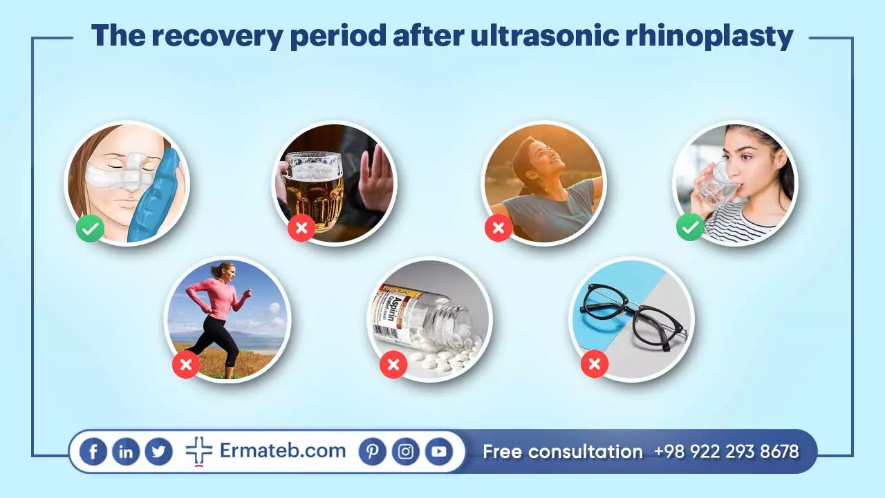 The recovery period after ultrasonic rhinoplasty