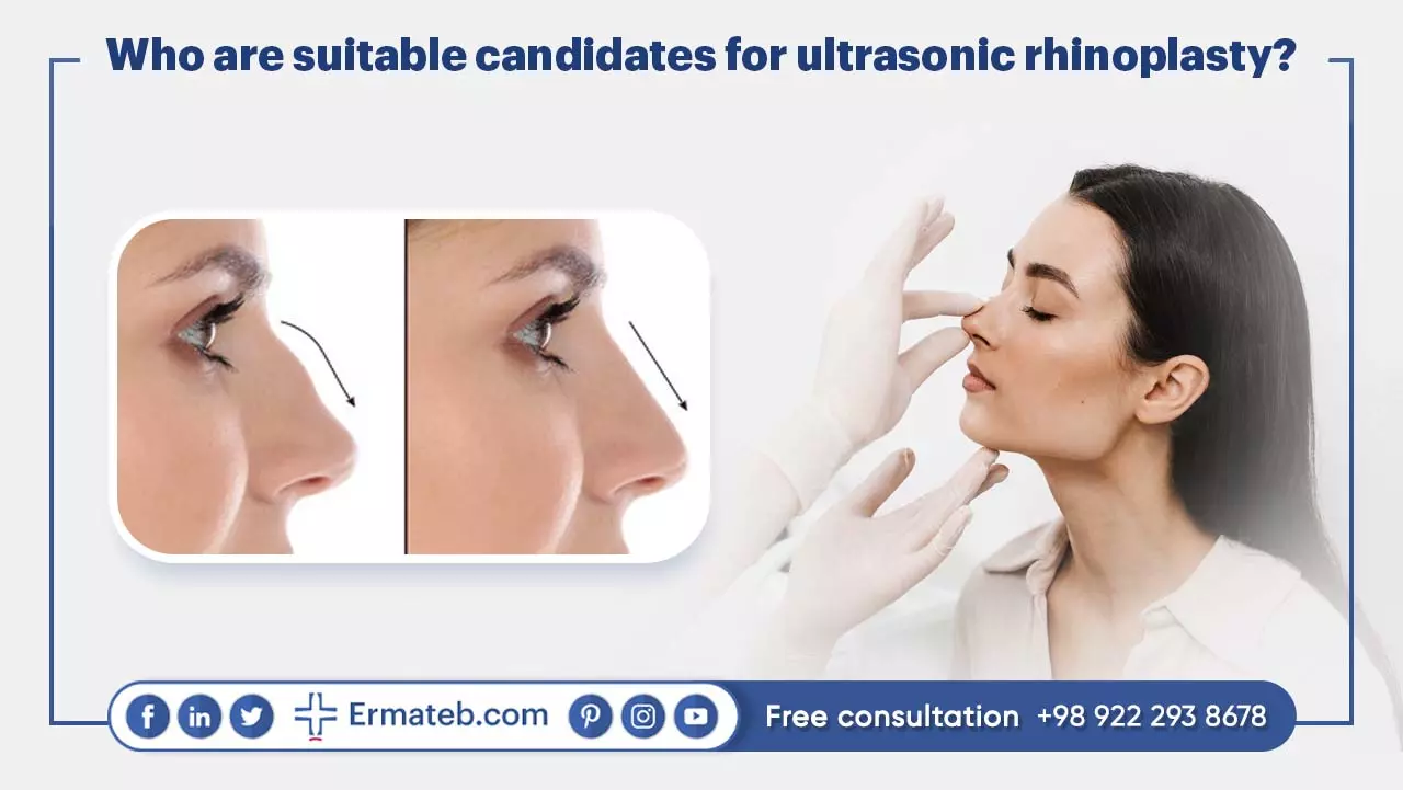 Who are suitable candidates for ultrasonic rhinoplasty?