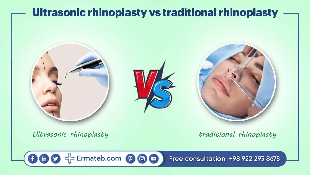 Ultrasonic rhinoplasty vs traditional rhinoplasty