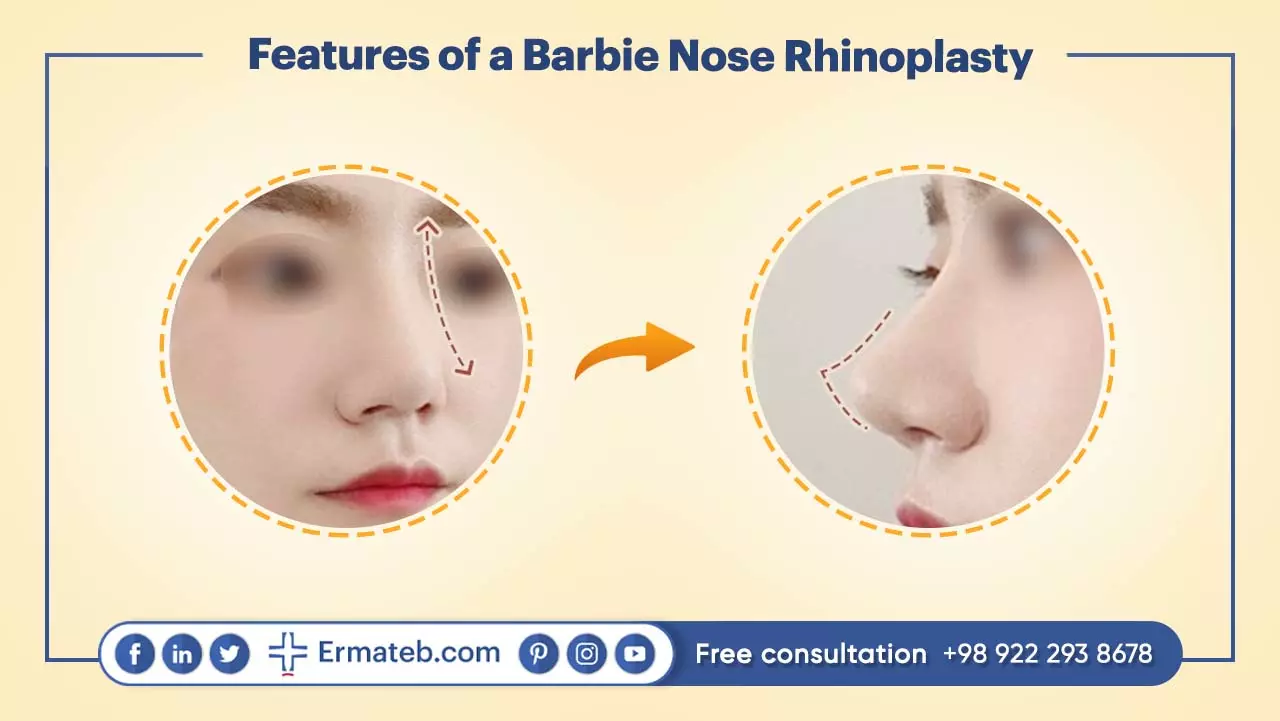 What are the Benefits of a Barbie Nose Rhinoplasty