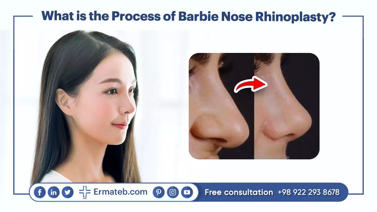 How is Barbie nose rhinoplasty performed?