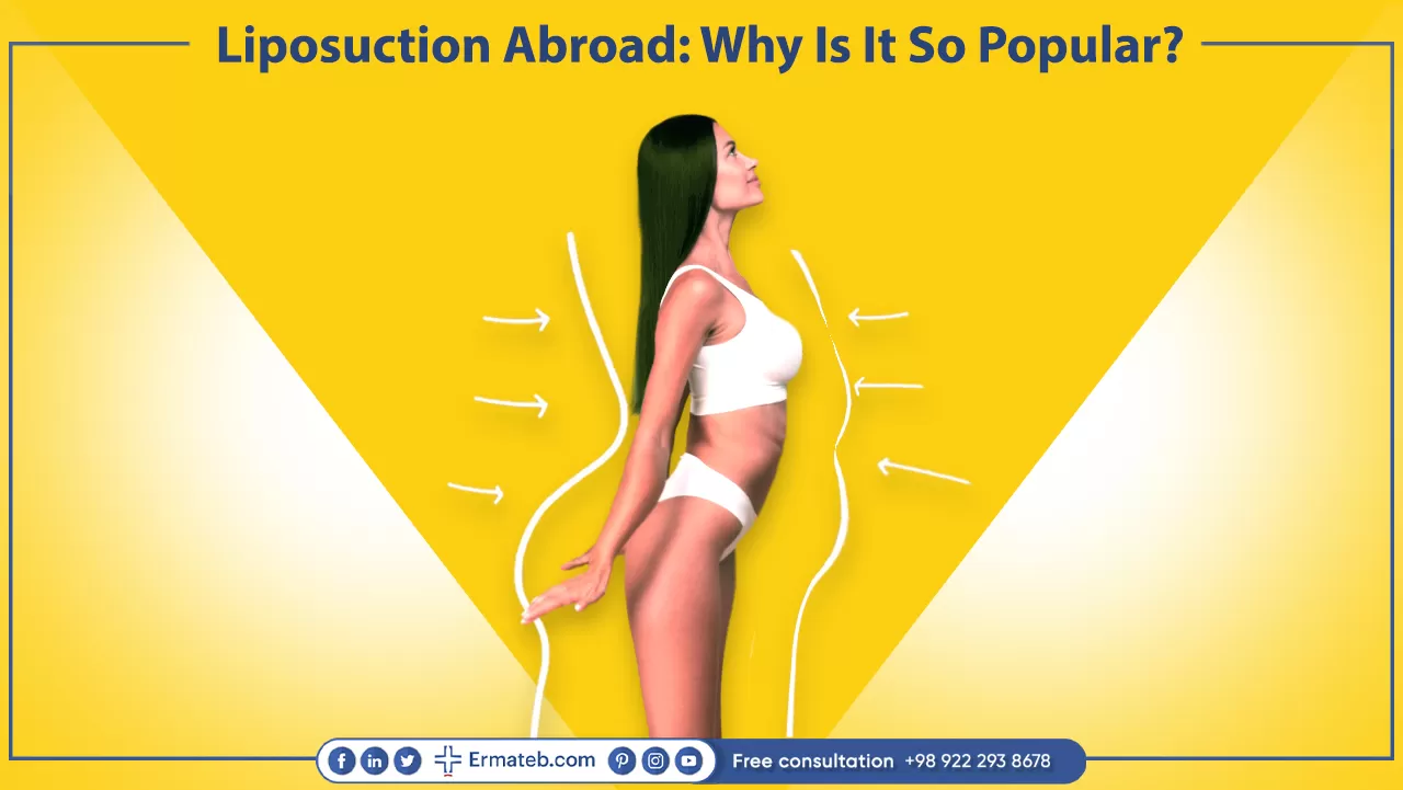 Liposuction Abroad: Why Is It So Popular?