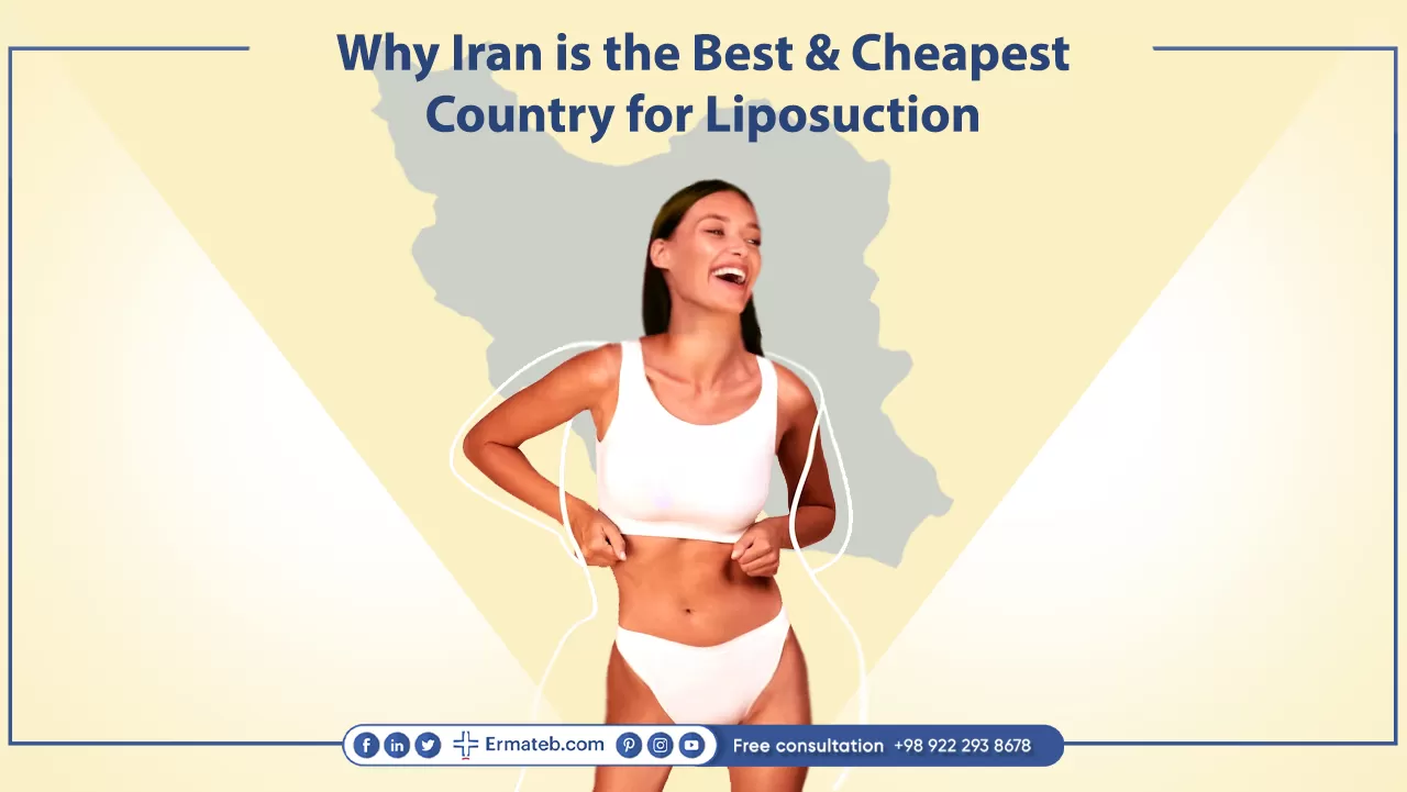 Why Iran is the Best and Cheapest Country for Liposuction?