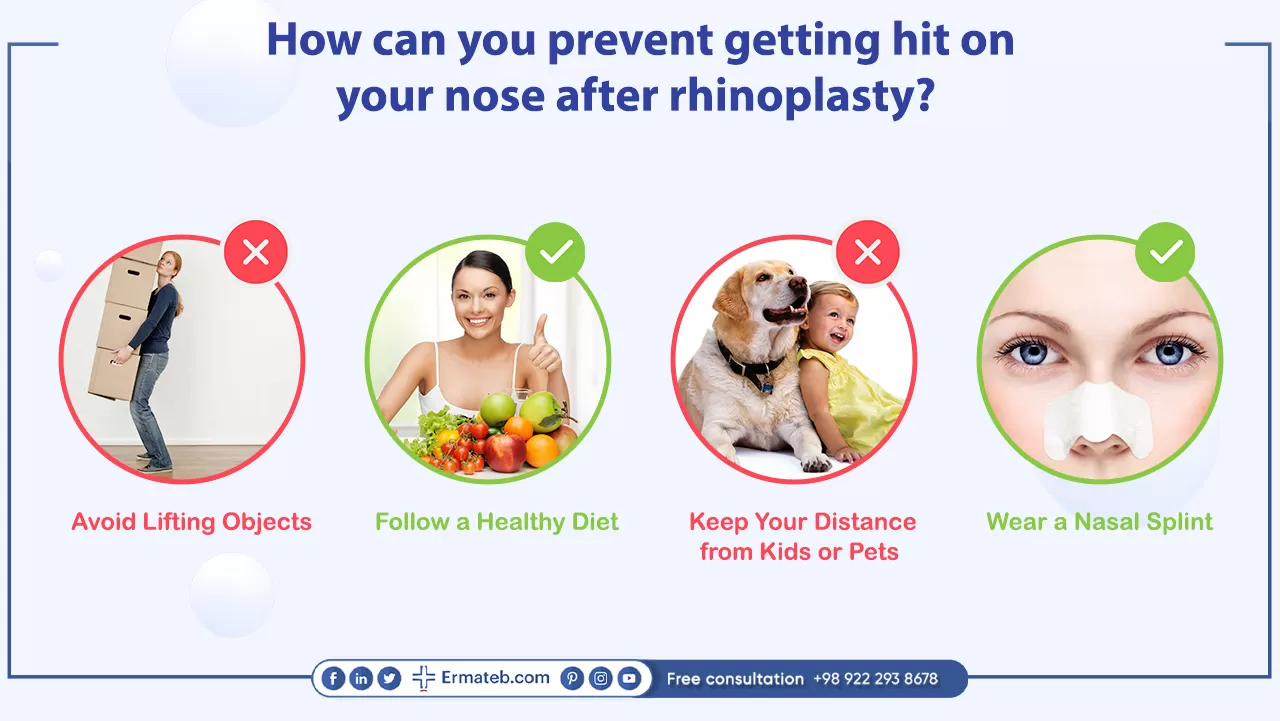 How can you prevent getting hit on your nose after rhinoplasty?