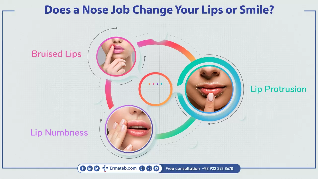 Does a nose job change your lips or smile?