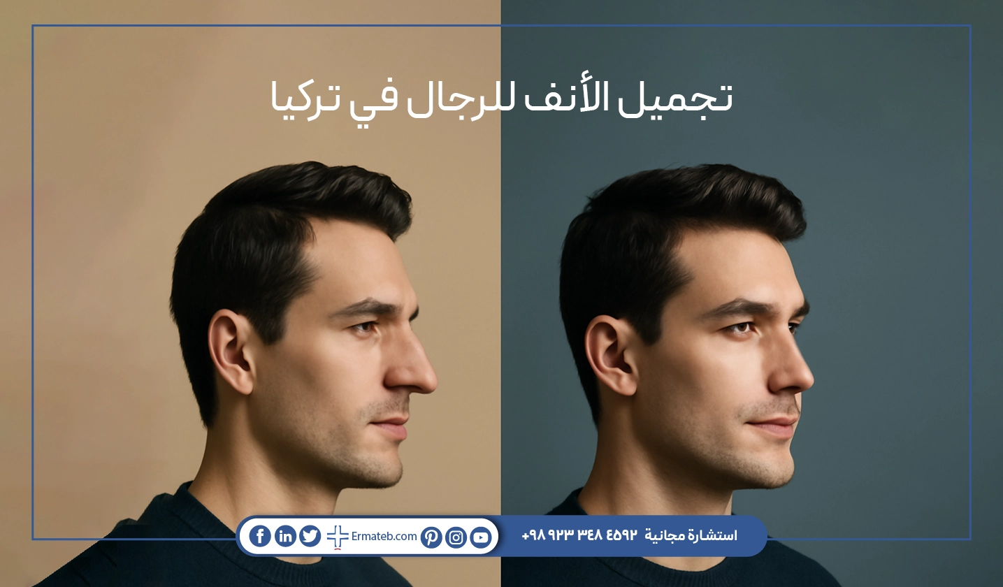 /تجمیل-الأنف-للرجال-في-تركيا