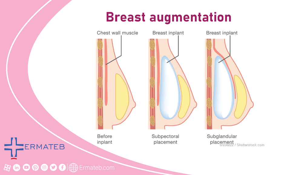 A Biased View of 5 Types Of Breast Surgery & What They Can Do For You thumbnail