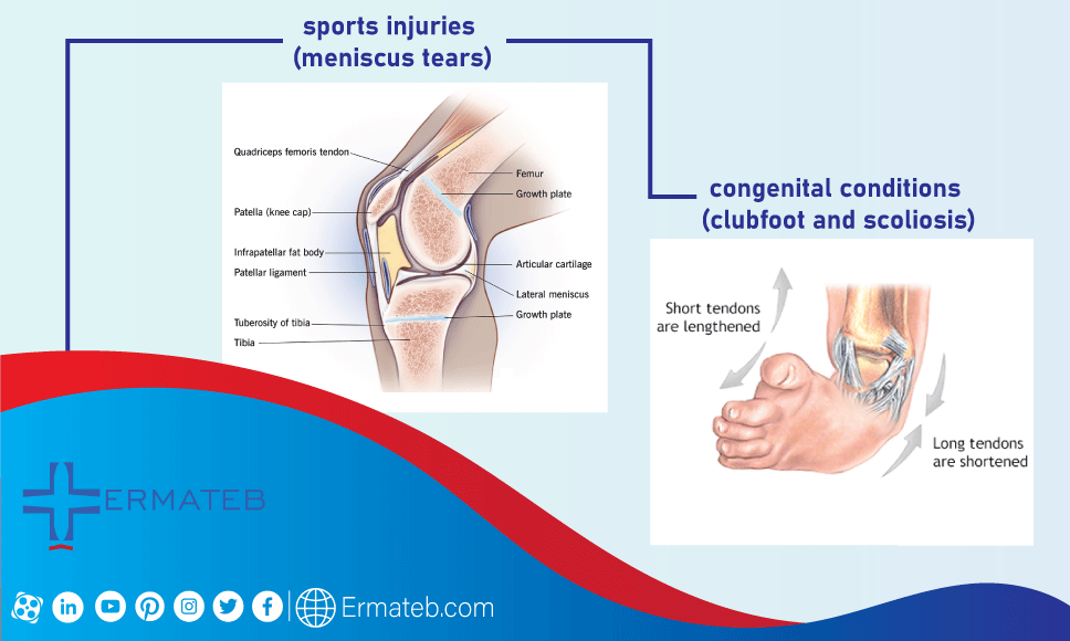 sport injury, congenital conditions