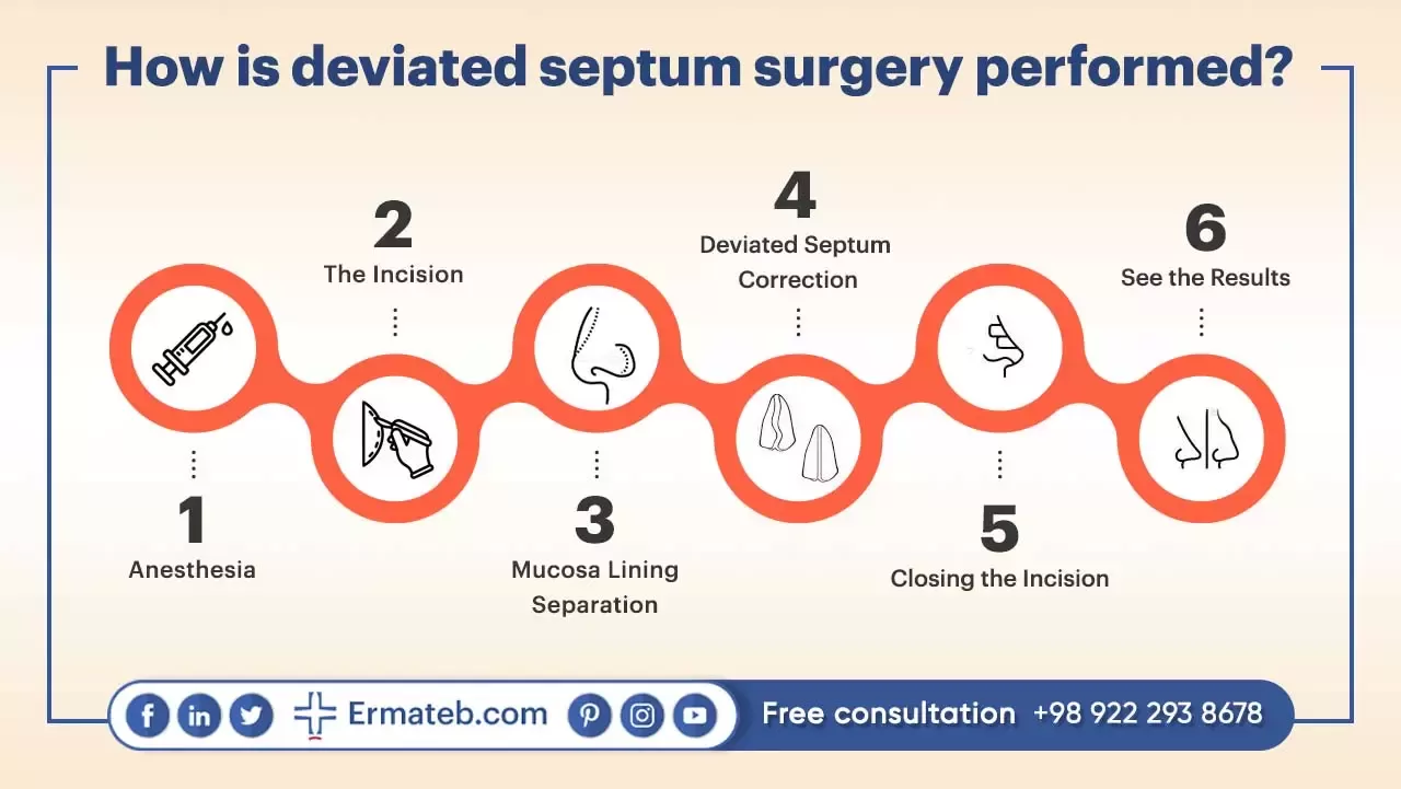 septum surgery performance