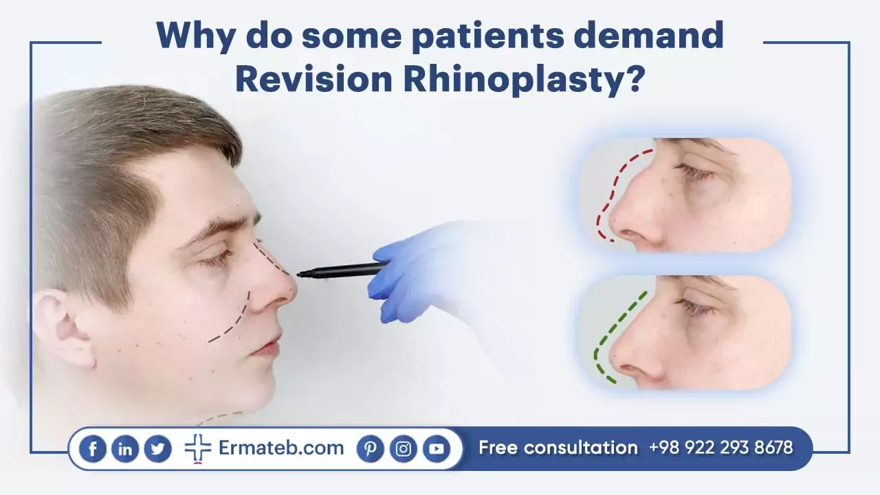 patients demand Revision Rhinoplasty