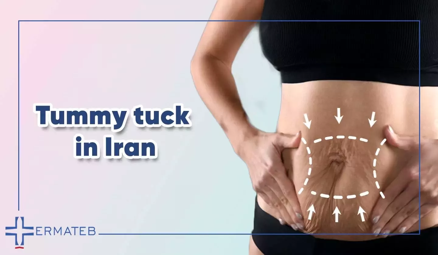 tummy tuck in Iran