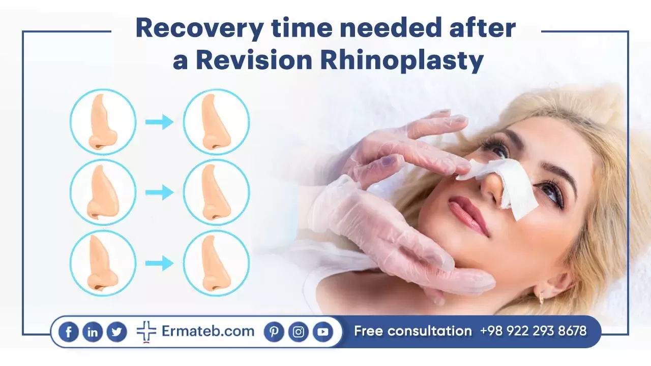 Recovery time for Revision Rhinoplasty