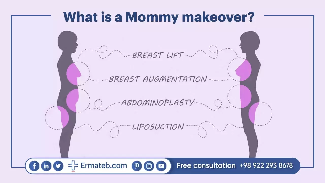 Mommy makeover