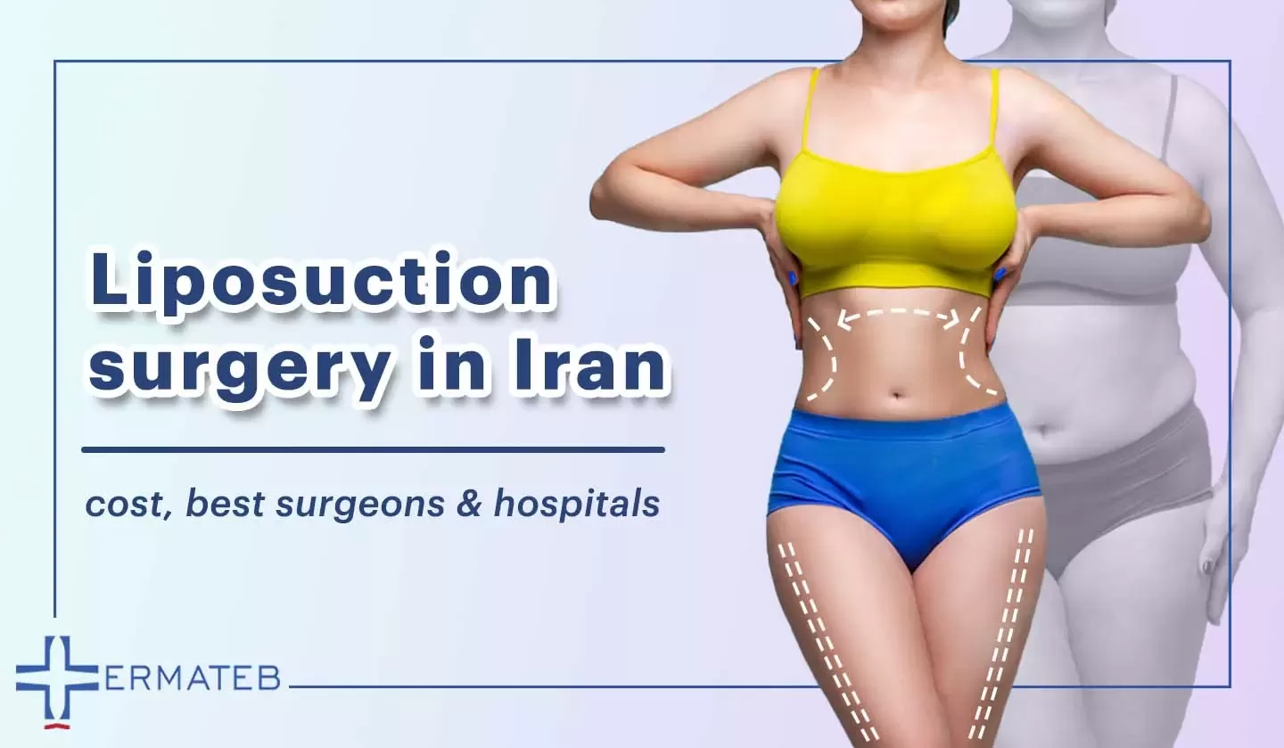 liposuction surgery in Iran