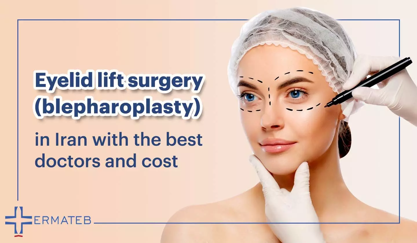 Eyelid lift surgery (blepharoplasty) in Iran
