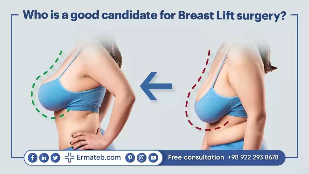 candidate for Breast Lift surgery