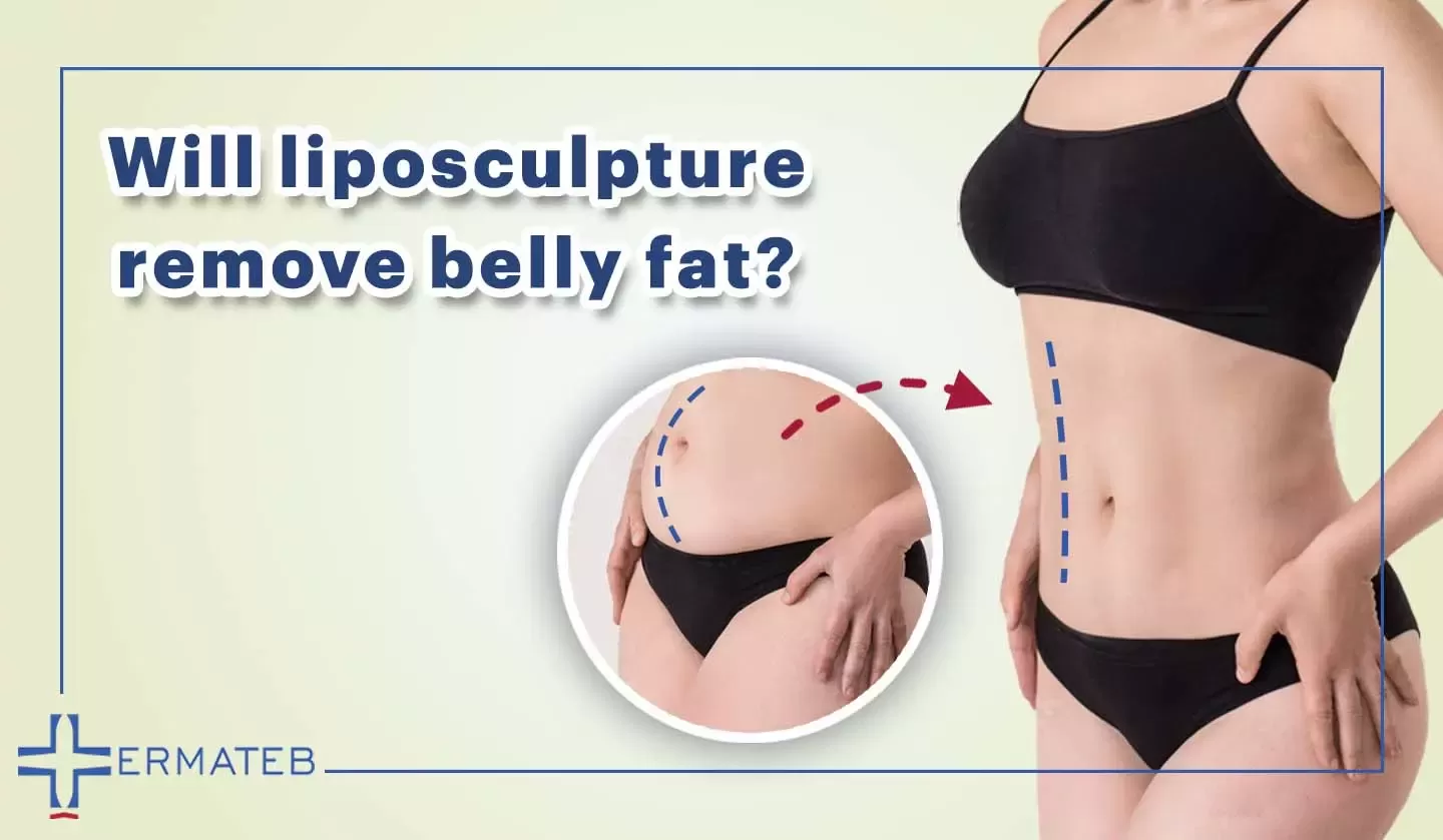 remove belly fat with liposculpture 