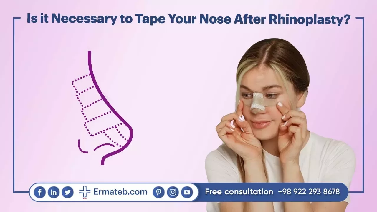  Is it Necessary to Tape Your Nose After Rhinoplasty?