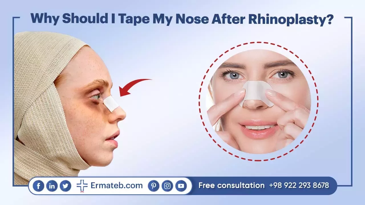 Why Should I Tape My Nose After Rhinoplasty?