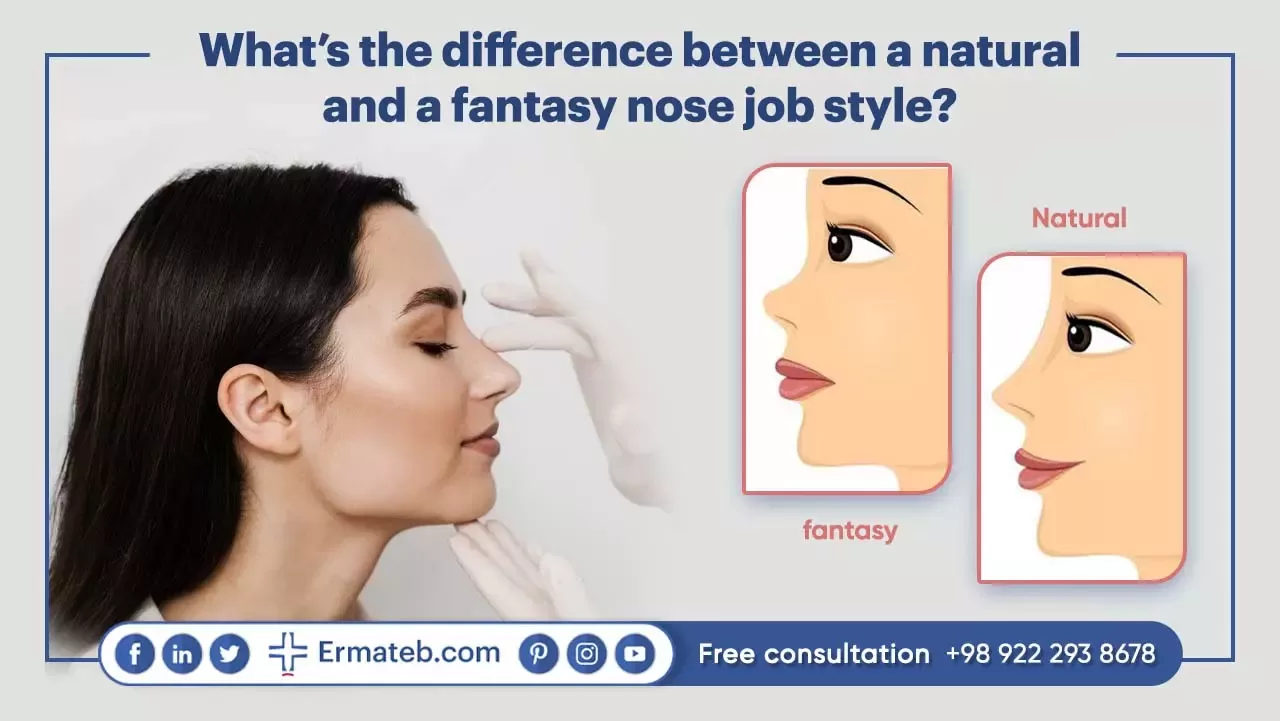 What’s the difference between a natural and a fantasy nose job style?