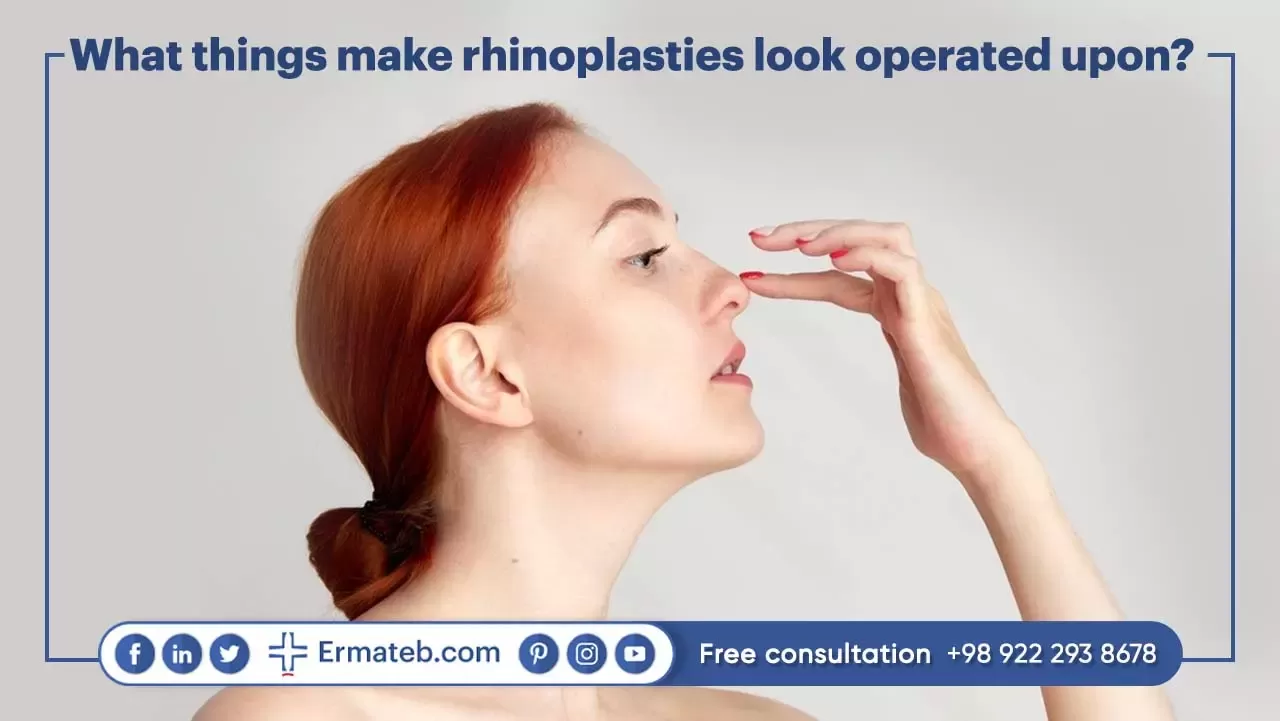 What things make rhinoplasties look operated upon?