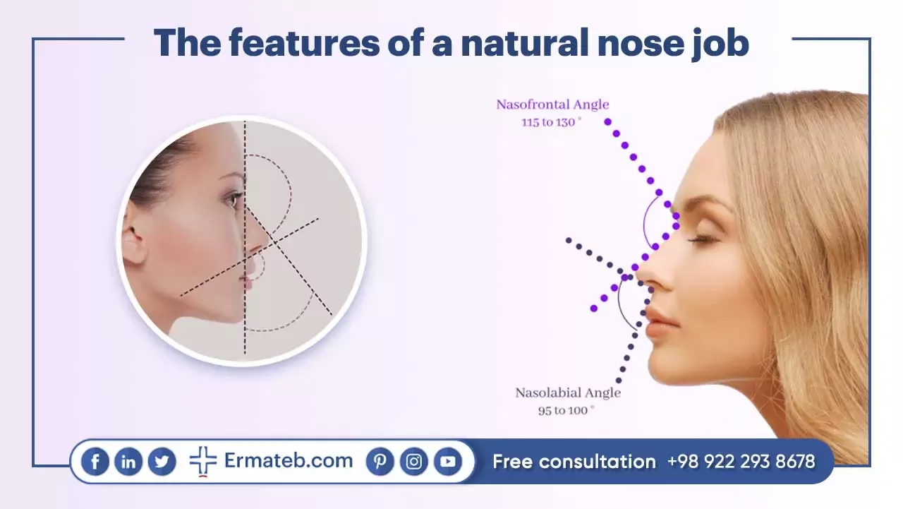 The features of a natural nose job
