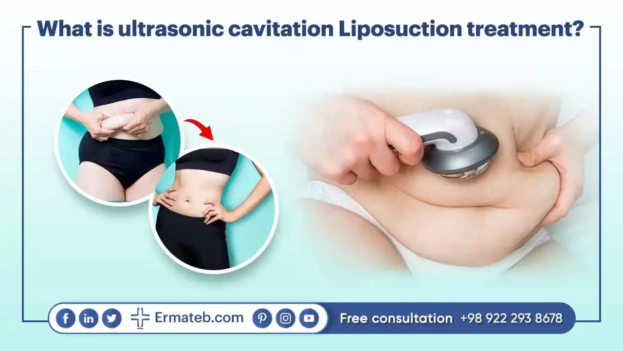 What is ultrasonic cavitation Liposuction treatment?