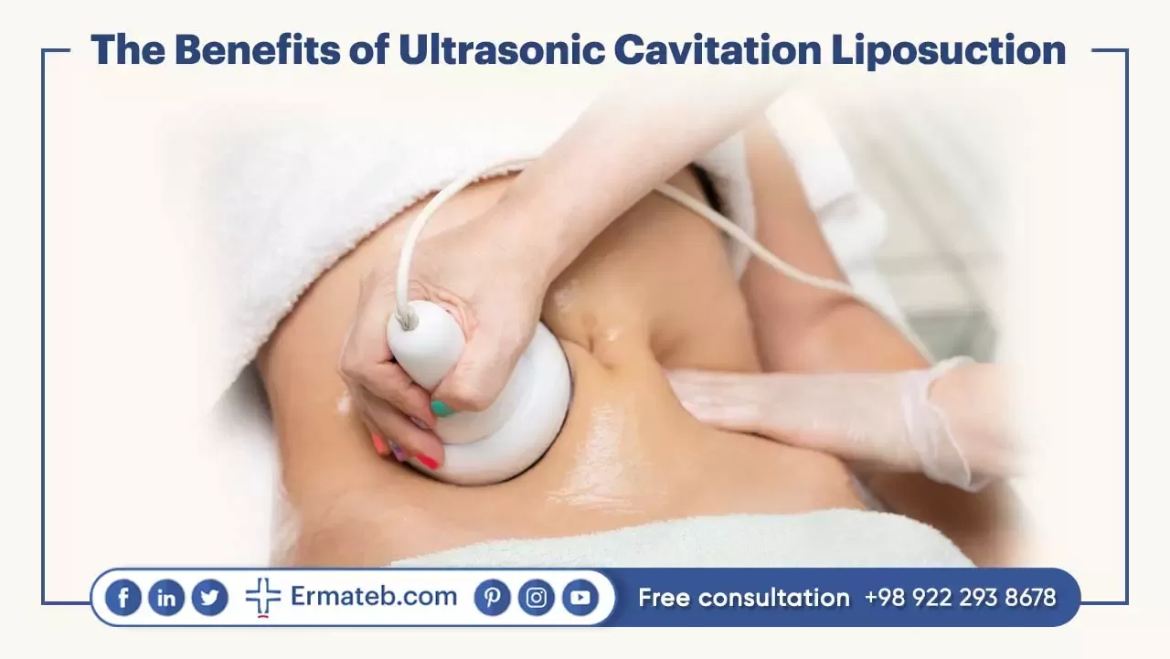 The Benefits of Ultrasonic Cavitation Liposuction