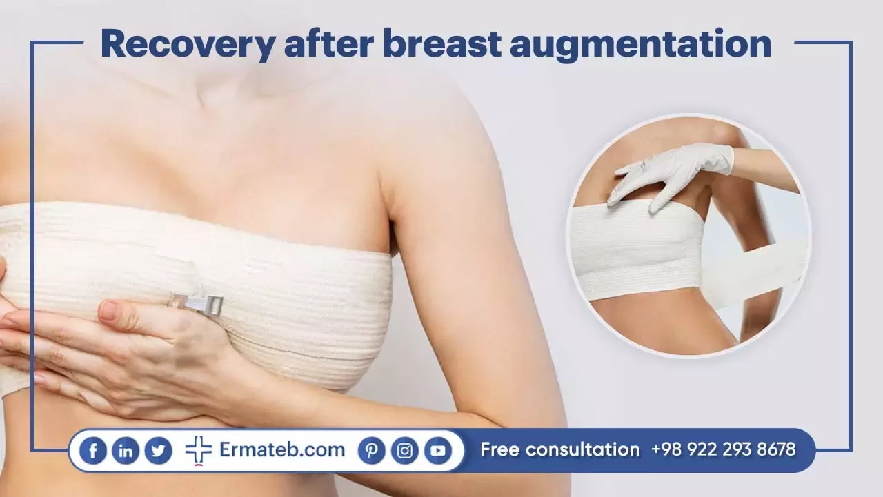 Recovery after breast augmentation