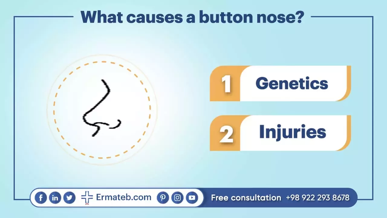 What causes a button nose?