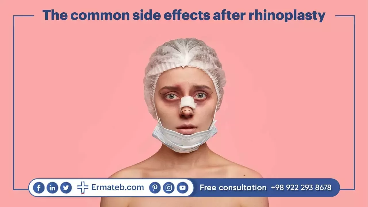 The common side effects after rhinoplasty