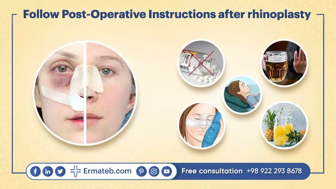 Follow Post-Operative Instructions after rhinoplasty