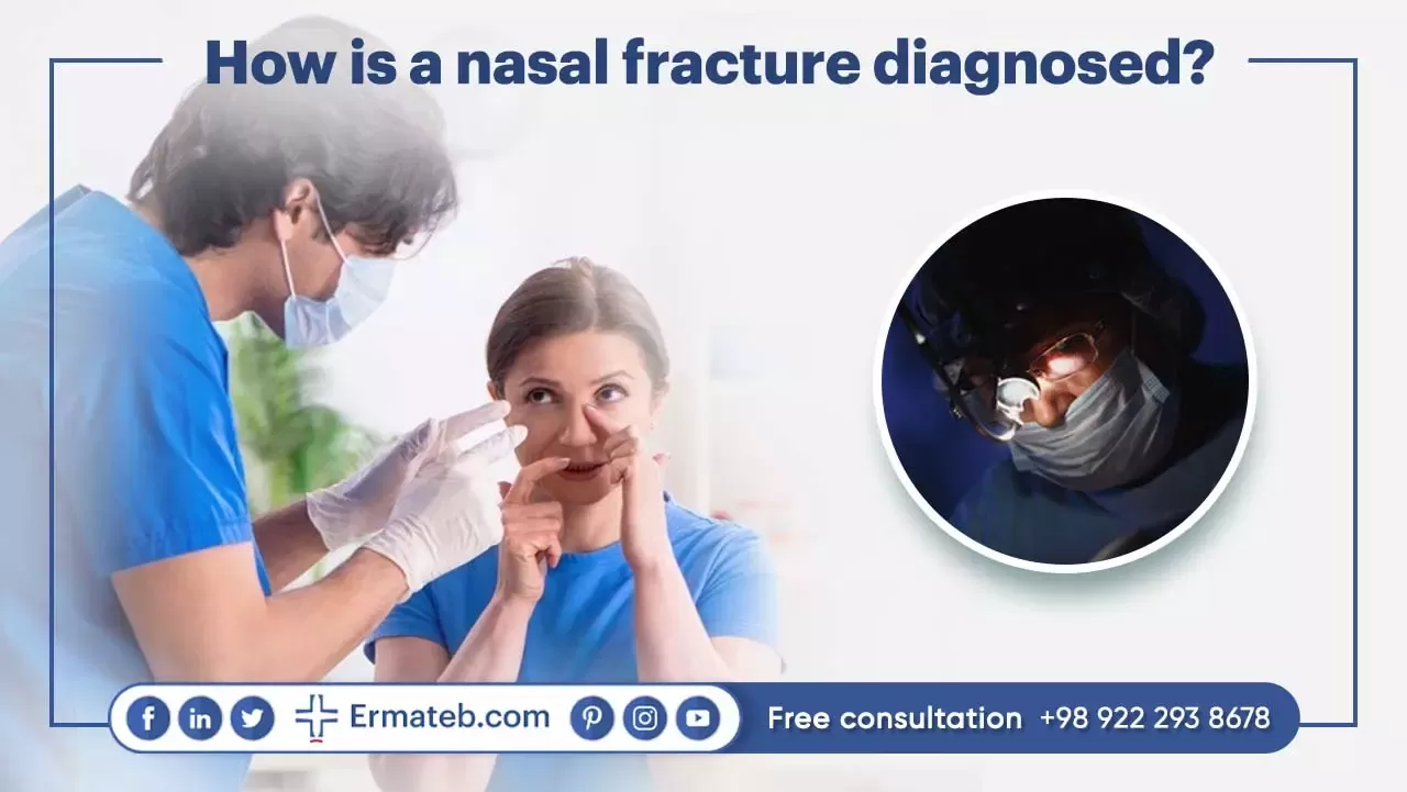 How is a nasal fracture diagnosed?