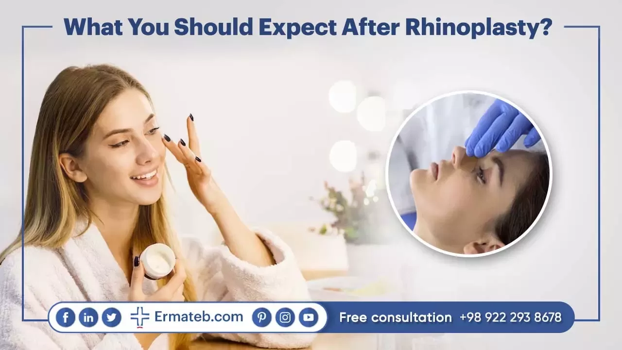 What You Should Expect After Rhinoplasty?