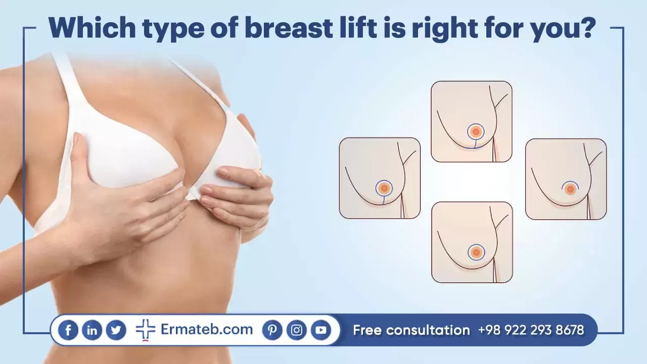 Which type of breast lift is right for you?
