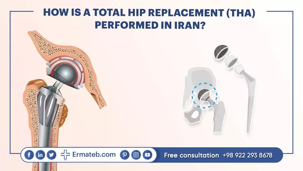 HOW IS A TOTAL HIP REPLACEMENT (THA) PERFORMED IN IRAN?