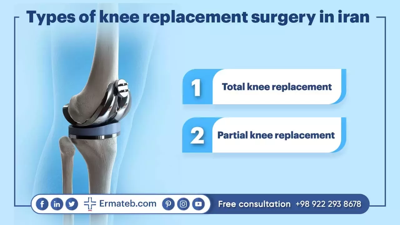 TYPES OF KNEE REPLACEMENT SURGERY IN IRAN 