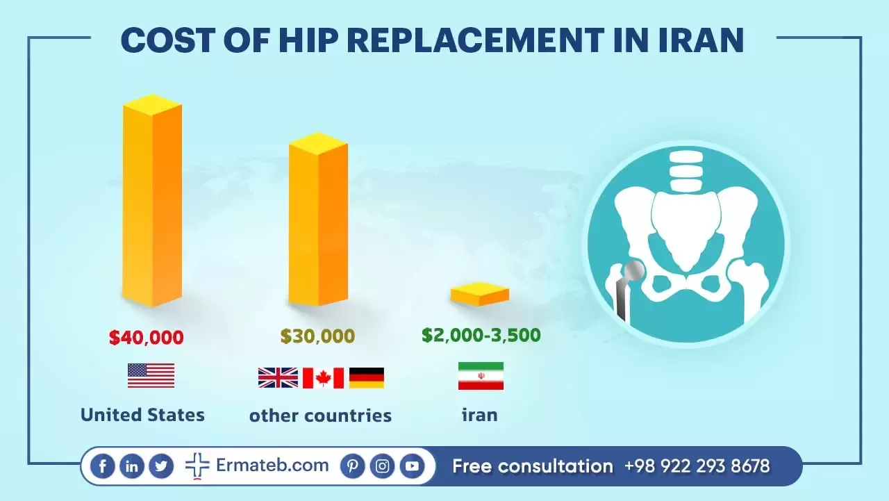 COST OF HIP REPLACEMENT IN IRAN