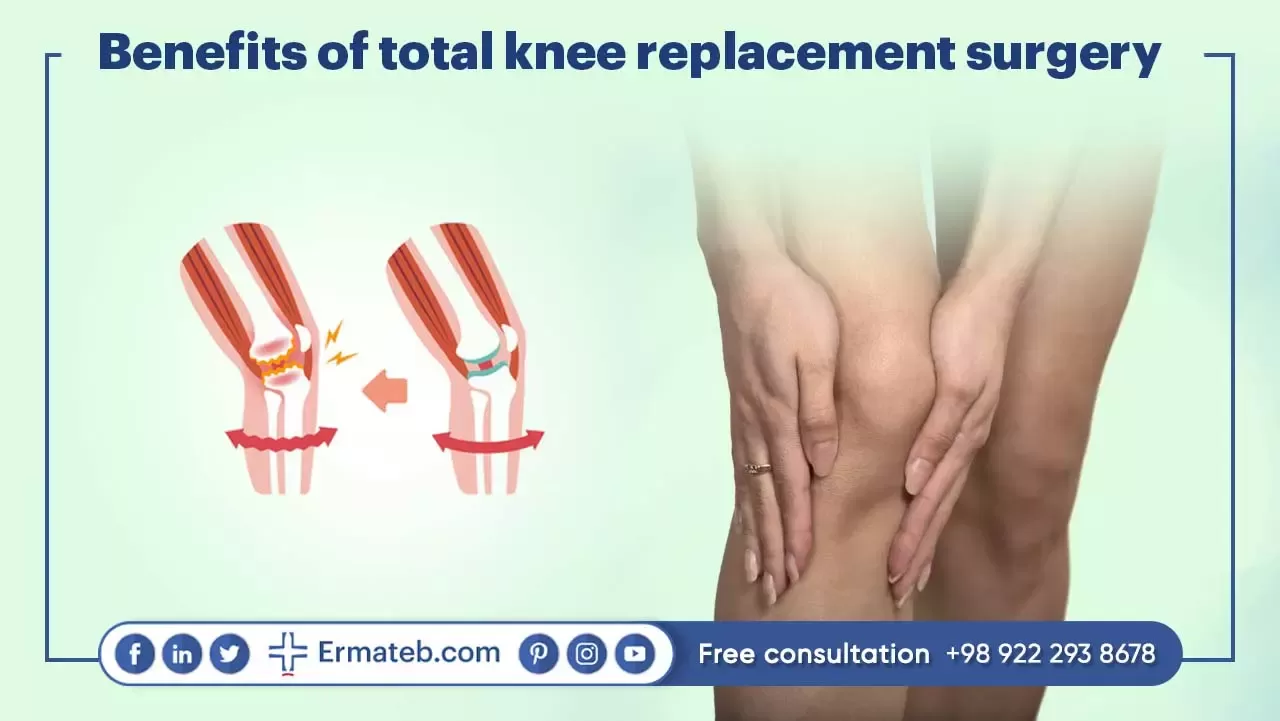 BENEFITS OF TOTAL KNEE REPLACEMENT SURGERY