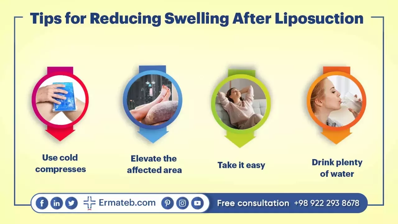 Tips for Reducing Swelling After Liposuction