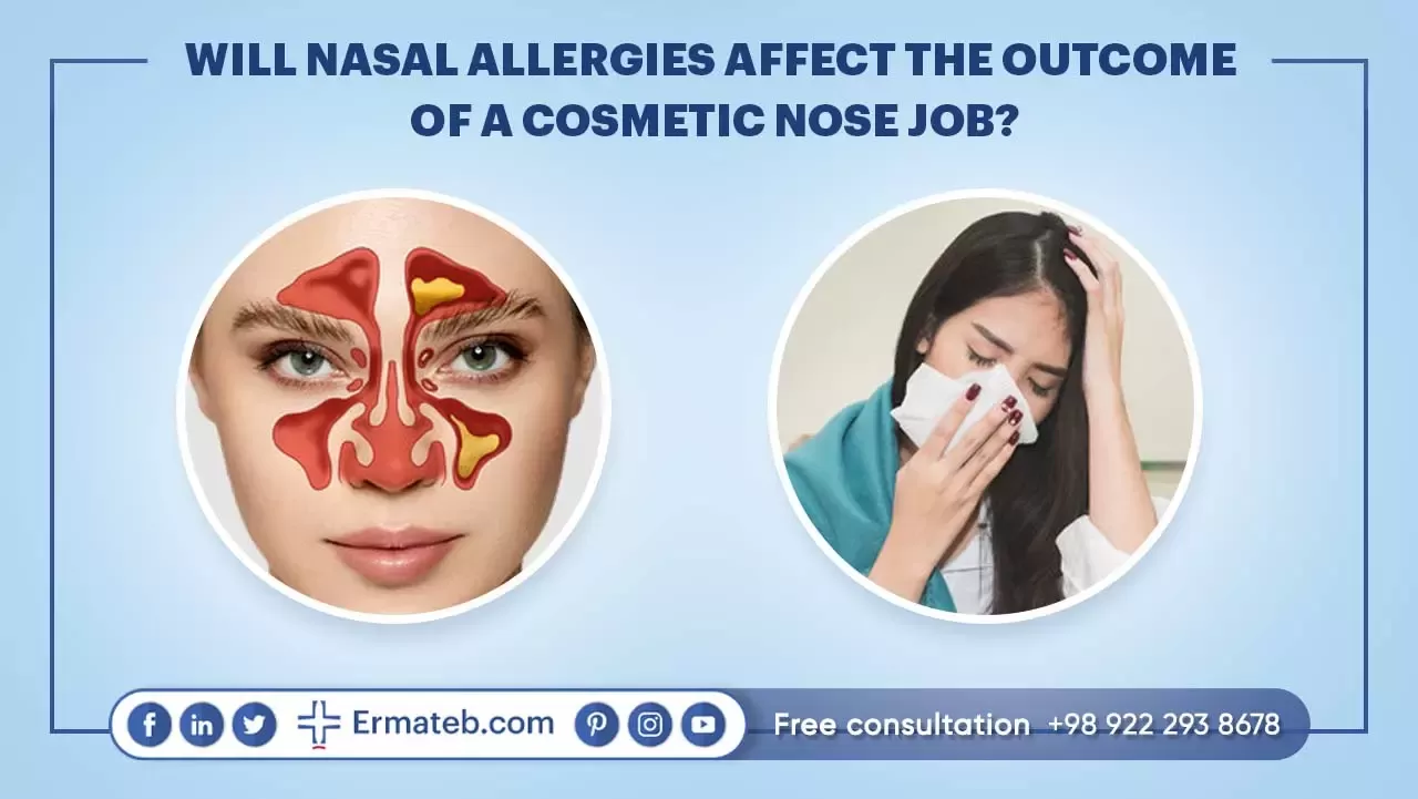 WILL NASAL ALLERGIES AFFECT THE OUTCOME OF A COSMETIC NOSE JOB?