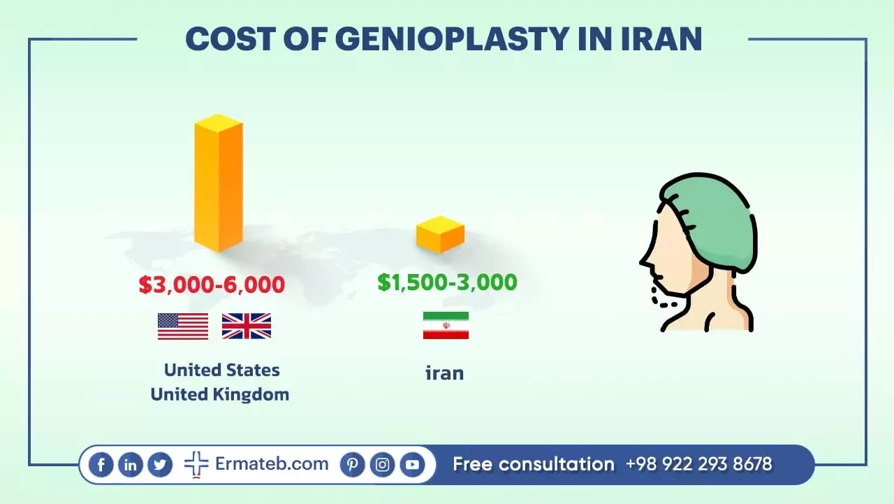 Cost of Genioplasty in Iran