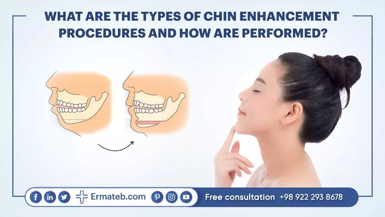 Types of Chin Enhancement Procedures
