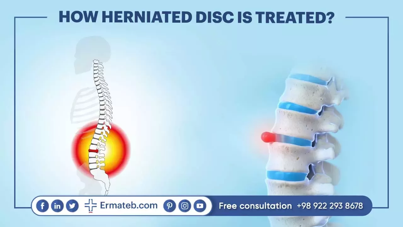 How Herniated disc is treated?