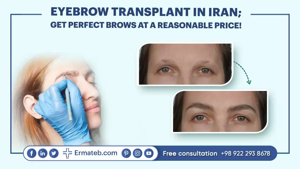EYEBROW TRANSPLANT IN IRAN; IS IT NATURAL OR ARTIFICIAL?