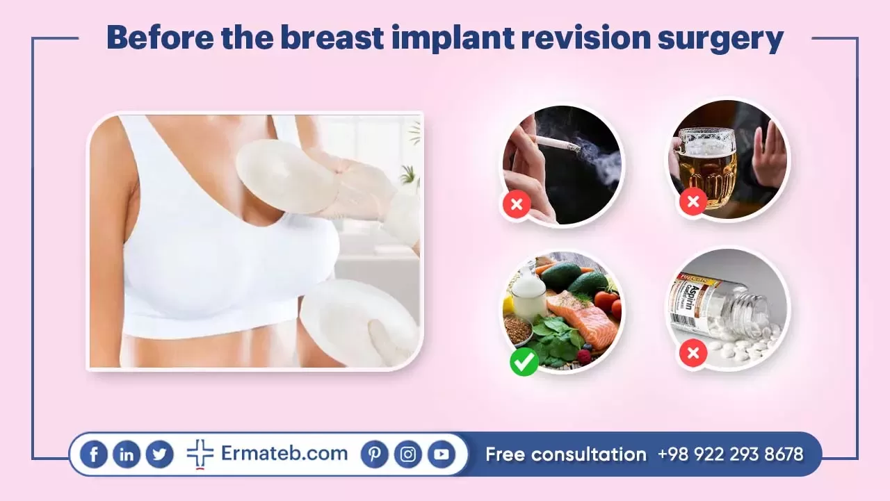 Before the breast implant revision surgery