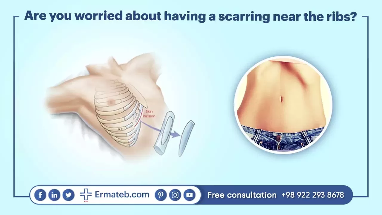 Are you worried about having a scarring near the ribs?