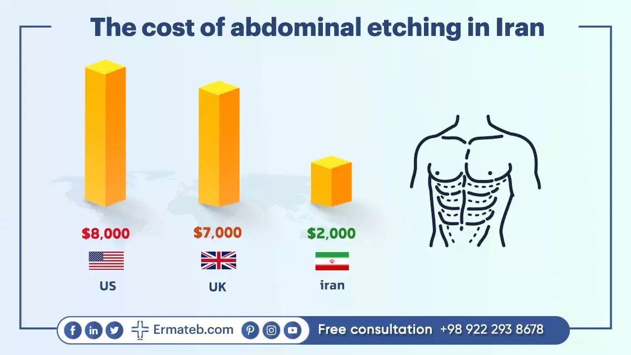 The cost of abdominal etching in Iran