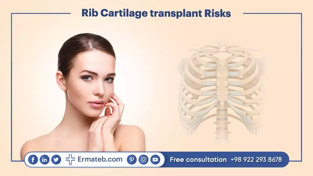 Rib Cartilage transplant Risks