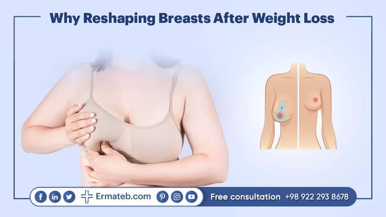 Why Reshaping Breasts After Weight Loss